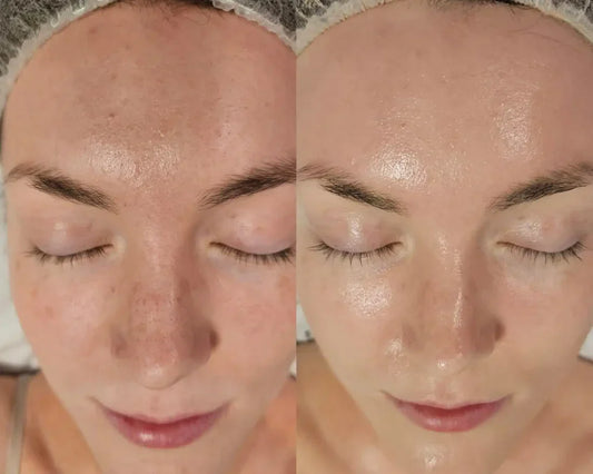 Dull Skin: What to Do? 7 Effective Solutions to Restore Natural Radiance