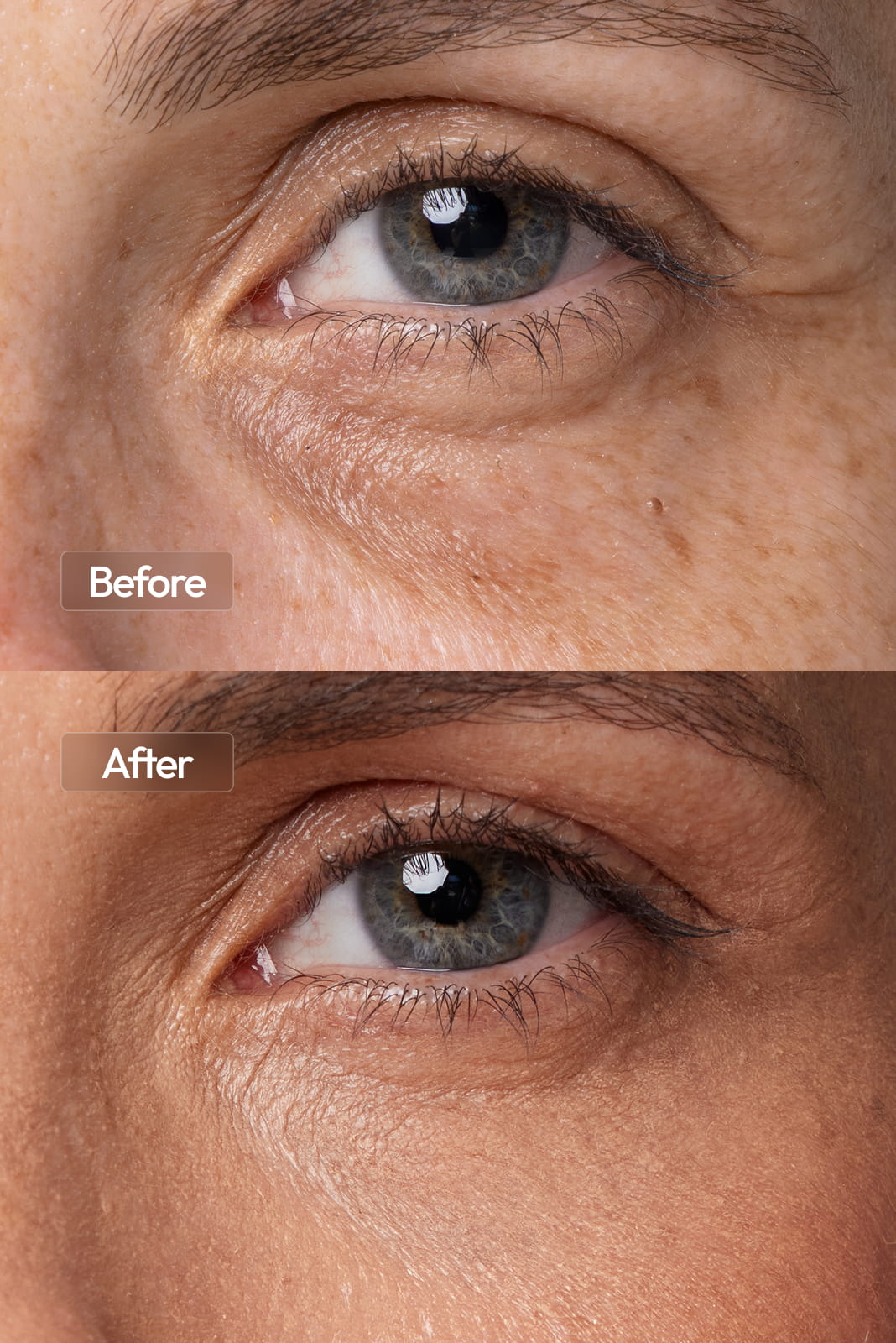 Anti-Aging Red Light Therapy Face Mask | Lumiglo Pro V2