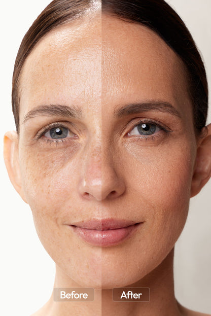 Anti-Aging Red Light Therapy Face Mask | Lumiglo Pro V2